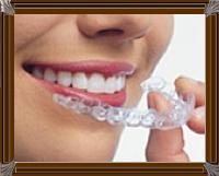 Invisalign