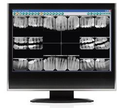 Dental Imaging Software